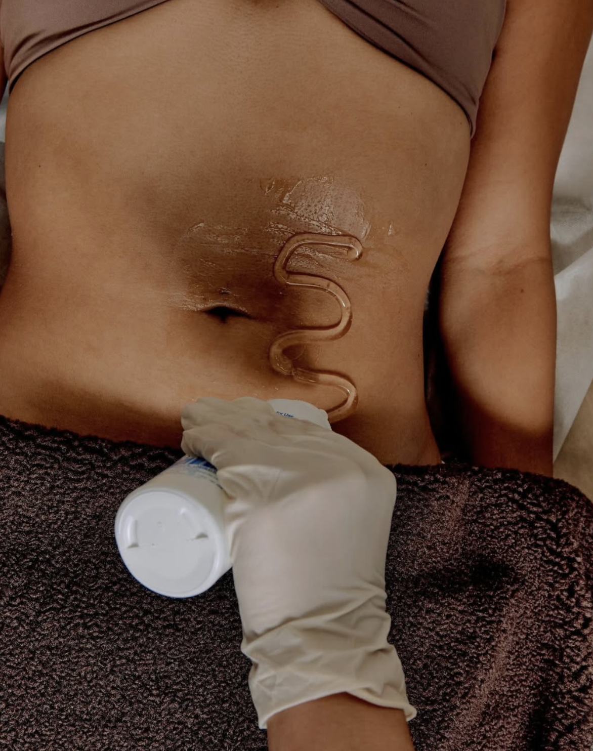 El Asilo body contouring treatment applied to the stomach area